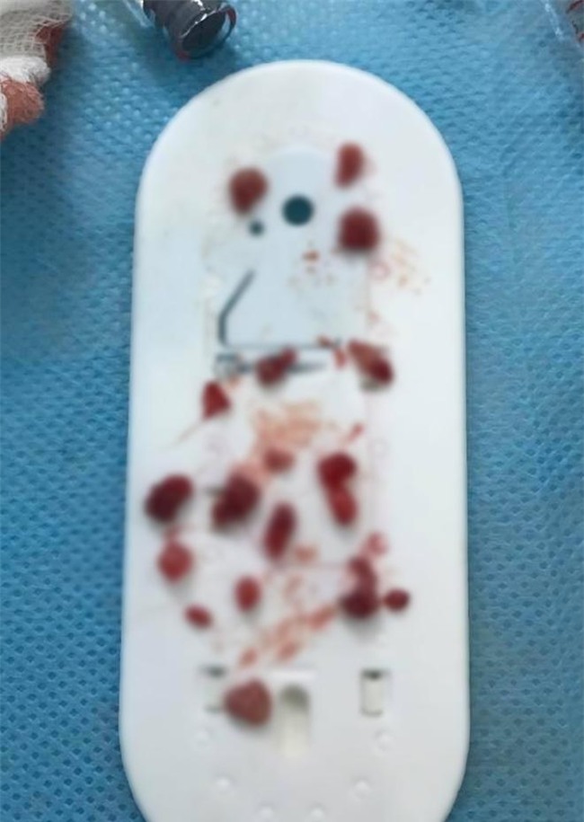 1001 tham hoa "lon lanh hoa que" khien chi em phai suy nghi ki truoc khi bom moi! - 5