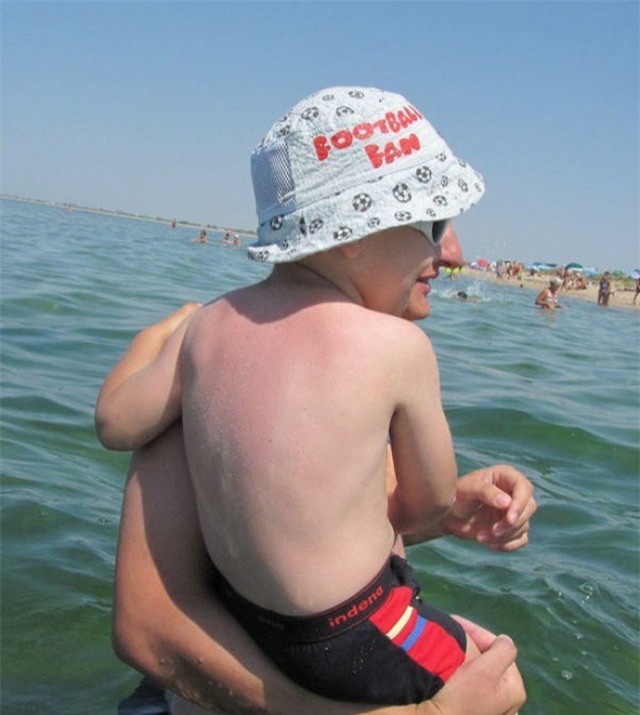 Em bé có gương mặt của người trưởng thành?