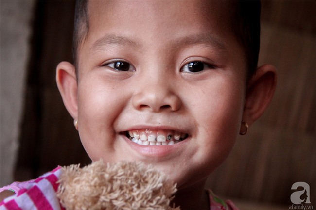 Tâm sự của bé gái 5 tuổi bị u não: Mẹ ơi! Mẹ cứu con đi, con lớn lên đi mần công ty trả tiền cho mẹ - Ảnh 2.