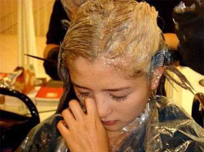 Mắc bệnh xơ gan giai đoạn cuối vì nhuộm tóc: Hãy 1 lần nghe bác sĩ nói-2