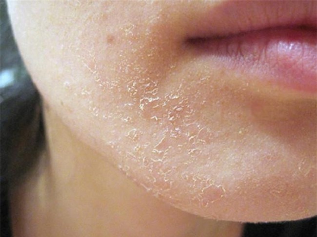 mach nho nang cach dap mat na ca chua an toan, hieu qua ma lai don gian va tiet kiem - 2