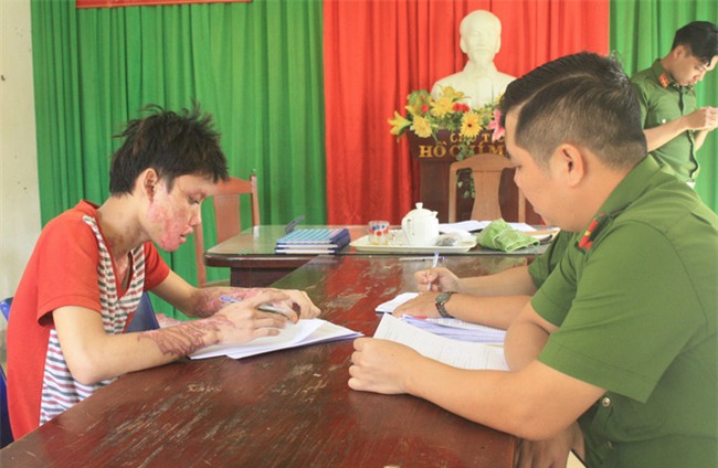 Đà Nẵng: Ghen tuông, nam thanh niên 20 tuổi tạt axít vào người yêu rồi tự sát - Ảnh 1.