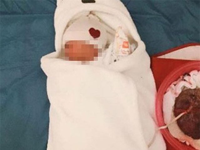 Những biến chứng cực kỳ nguy hiểm khi sinh con "thuận tự nhiên" - 1