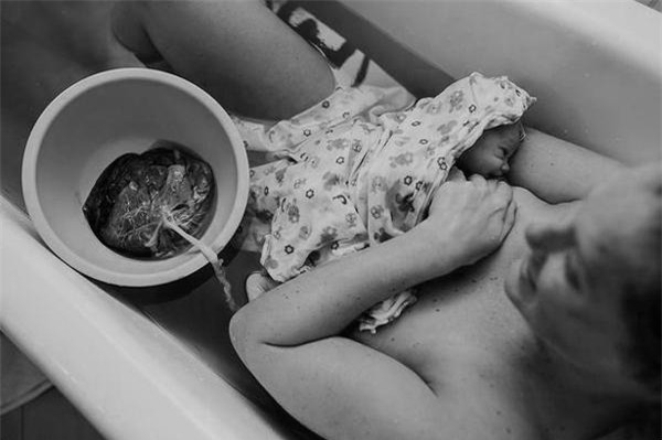 phuong phap sinh con “thuan tu nhien” dang gay tranh cai gay gat cu the la gi? - 2