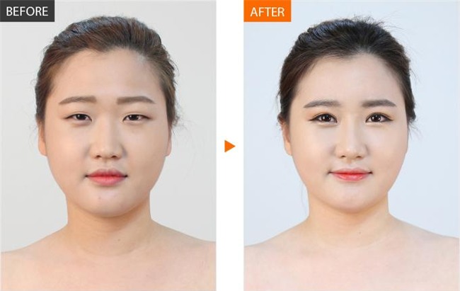 giai dap thac mac cua hang ngan chi em voi cau hoi:"cat mi mat co hai khong?" - 1