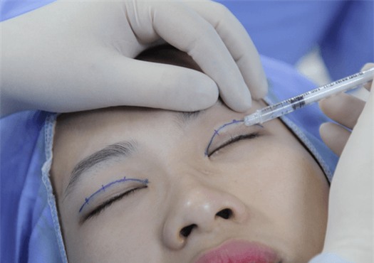 giai dap thac mac cua hang ngan chi em voi cau hoi:"cat mi mat co hai khong?" - 2