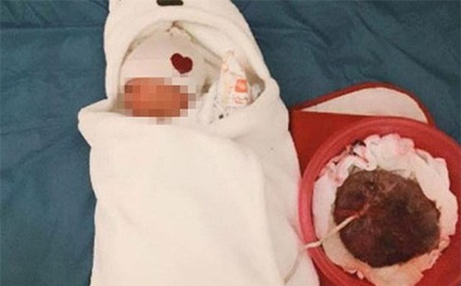 Sinh tự nhiên nguy cơ tử vong gấp 7 lần