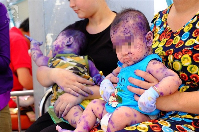 Đau lòng trước những hậu quả trẻ sơ sinh gánh phải khi người lớn cuồng phương pháp thuận tự nhiên - Ảnh 2.