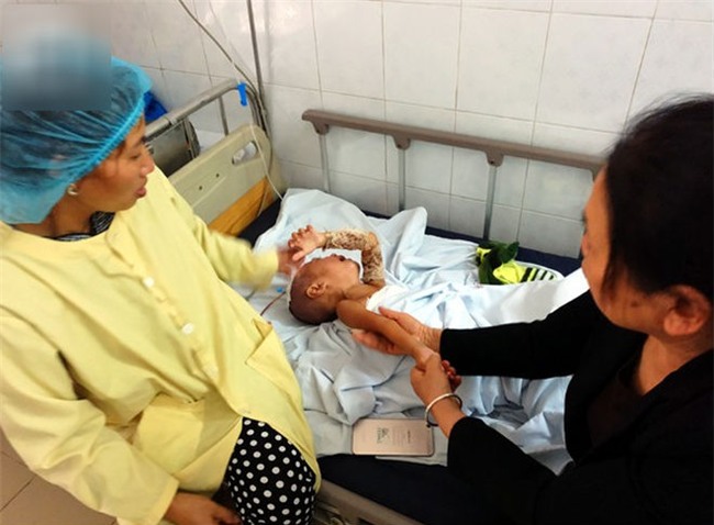 Đòi đến trường đón anh tan học, bé trai 3 tuổi bất ngờ vấp, ngã cả người vào nồi nước sôi bên đường