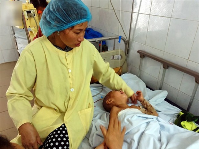 Đòi đến trường đón anh tan học, bé trai 3 tuổi bất ngờ vấp, ngã cả người vào nồi nước sôi bên đường