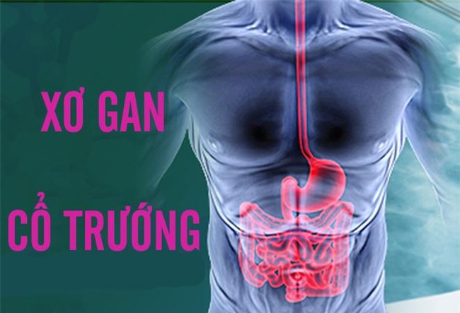 dung ngay viec uong ruou bia neu khong muon bi xo gan co truong - 1