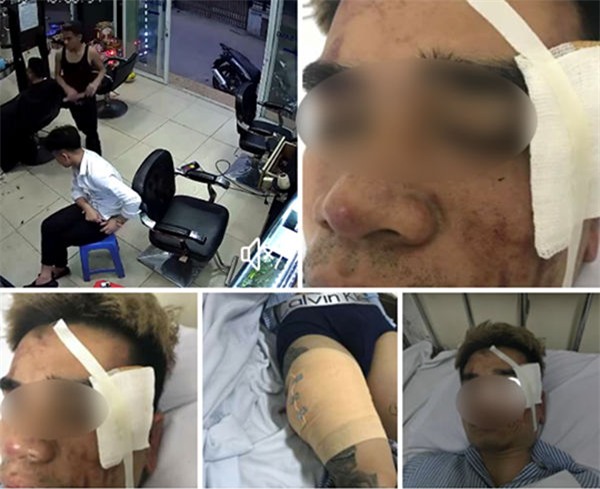 Vụ nổ súng bắn chủ quán cắt tóc ở Hà Nội: Do mâu thuẫn tình ái