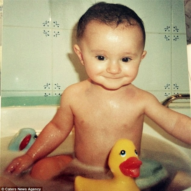 Bệnh lạ biến cô bé thành tượng sống nhưng cô kiên quyết không để nỗi đau thể xác hủy hoại cuộc đời mình - Ảnh 1.