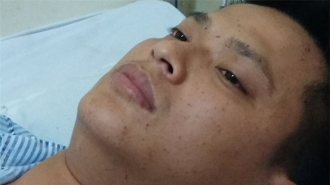 Trung úy điều khiển chiếc xe cứu hỏa gặp nạn: Em quá choáng và ngất ngay sau đó