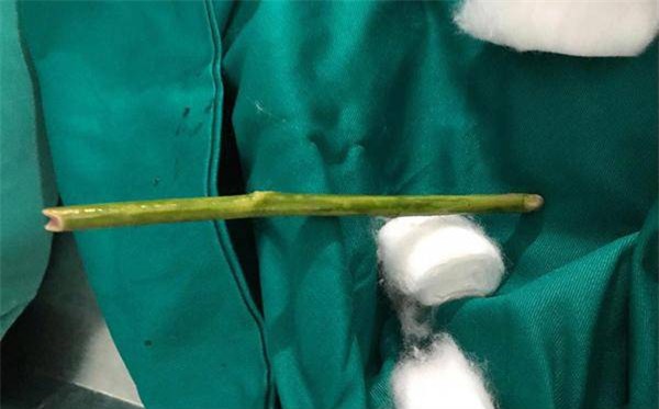 tin moi vu thai phu tu vong sau khi pha thai bang que: thay lang chi hoc het lop 7 - 1