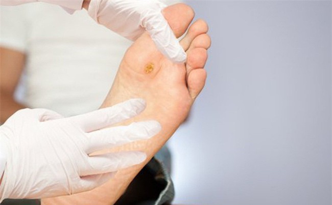 Chuyên gia chỉ 3 cách ngăn chặn và điều trị bệnh tiểu đường-1