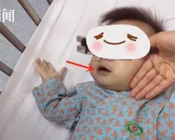 tri chung bieng an bang nuoc bi dao ngam 3 nam, me vo tinh khien cac con phai nhap vien - 1