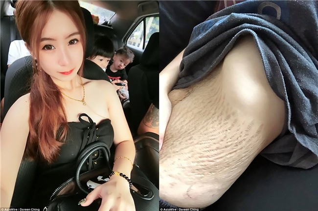 Đăng ảnh chiếc bụng rạn sau khi sinh bốn, người mẹ trẻ xinh đẹp bị dân mạng đổ lỗi ngược lại vì... sinh quá nhiều con! - Ảnh 1.