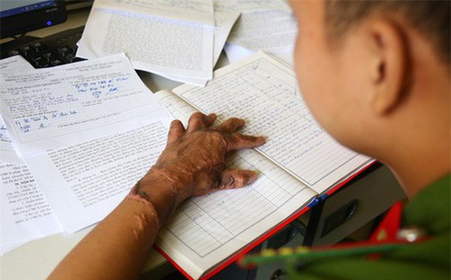 Chàng lính trẻ từ bỏ giấc mơ làm chiến sĩ PCCC vì gặp nạn trong lúc cứu hỏa: 