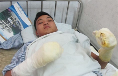 Chàng lính trẻ từ bỏ giấc mơ làm chiến sĩ PCCC vì gặp nạn trong lúc cứu hỏa: Mỗi lần nghe báo cháy, lại thấy nhớ nghề và đồng đội... - Ảnh 5.