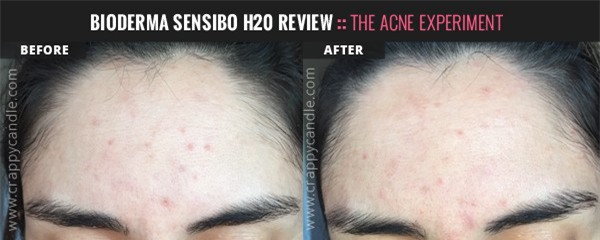 Thay đổi sản phẩm chăm sóc da liên tục, nhưng cô nàng này quyết trung thành với lọ tẩy trang giá rẻ này  - Ảnh 15.