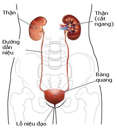 Dấu hiệu báo nhiễm trùng đường tiểu: Phát hiện sớm để ngừa suy thận và nhiễm trùng máu - Ảnh 1.