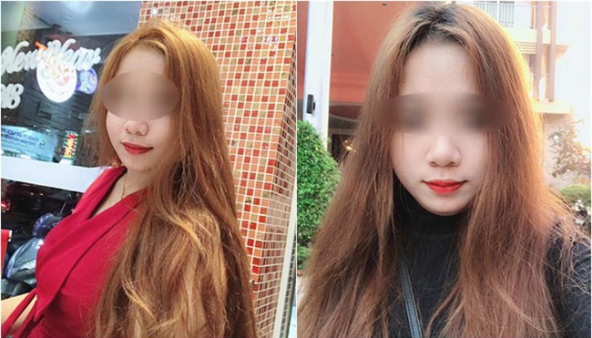 Trải nghiệm kinh hoàng của cô gái suýt hỏng mũi vì tiêm filler, mới 2 ngày đã sưng mọng, mưng mủ trắng kín đầu mũi - Ảnh 4.