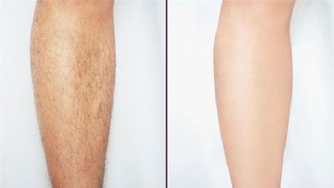 vo nat nam la trau khong dem dun theo cach nay, long "canh" se tu rung khong con 1 cong - 7