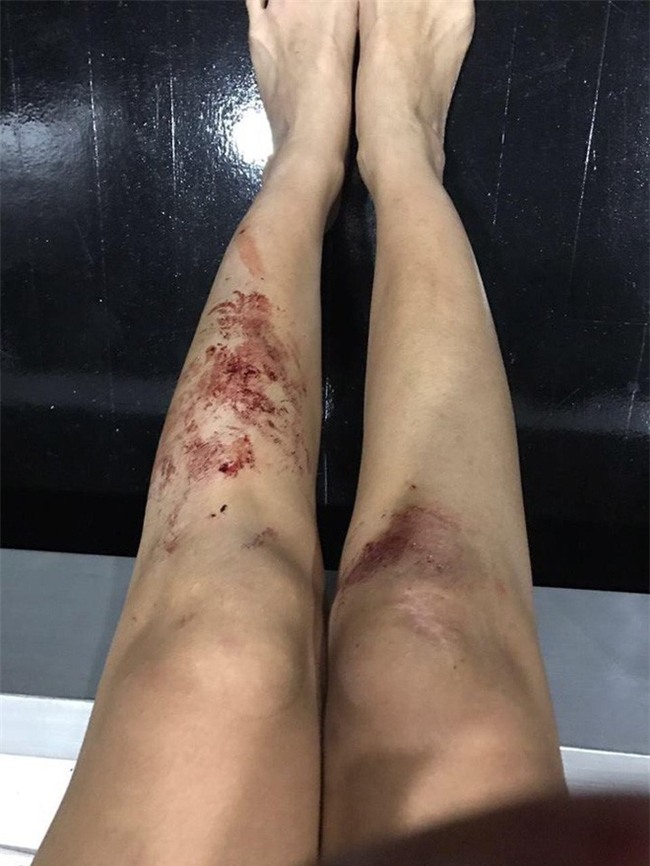 Nữ DJ gợi cảm đăng hình ảnh tàn tạ, rớm máu và sự thật gây sốc - Ảnh 2.