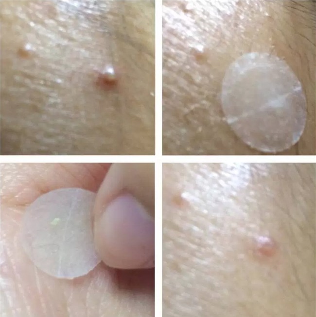 Nàng nào đang khốn khổ vì mụn, chớ bỏ qua loạt đồ dược mỹ phẩm được bác sĩ da liễu tin dùng này - Ảnh 11.