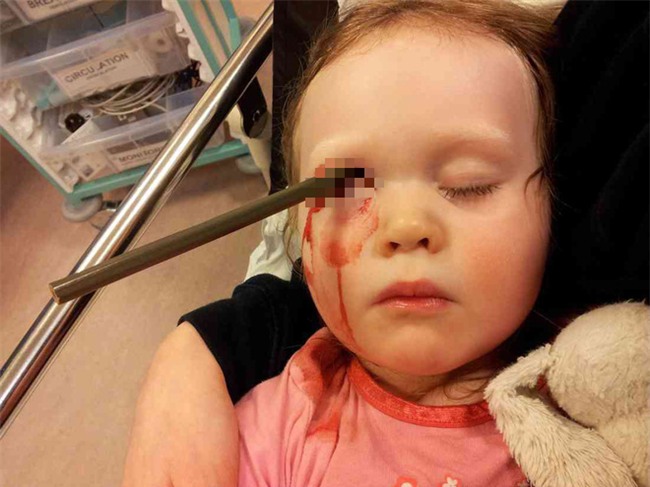 Hớn hở chạy khoe bố mẹ bức tranh mới vẽ, ngờ đâu tai họa ập xuống suýt lấy mạng cô bé 2 tuổi - Ảnh 1.