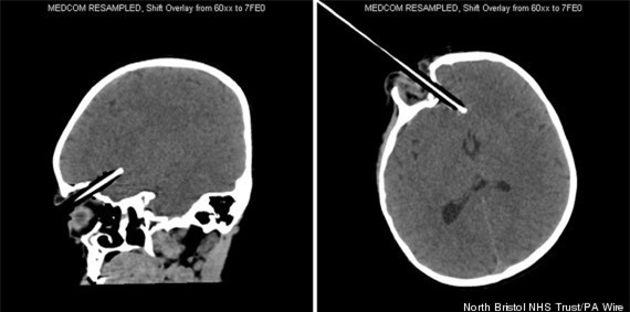 Hớn hở chạy khoe bố mẹ bức tranh mới vẽ, ngờ đâu tai họa ập xuống suýt lấy mạng cô bé 2 tuổi - Ảnh 2.