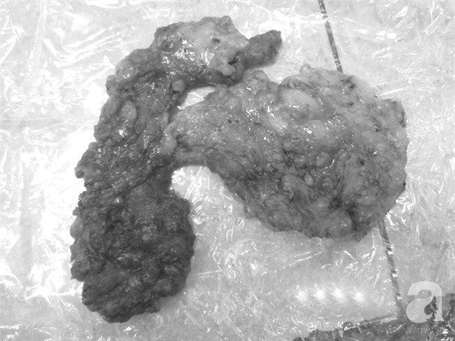 Lén chồng đi tiêm “mỡ nhân tạo” lên ngực, cô vợ 37 tuổi ở TP.HCM nhận cái kết nặng nề - Ảnh 2.