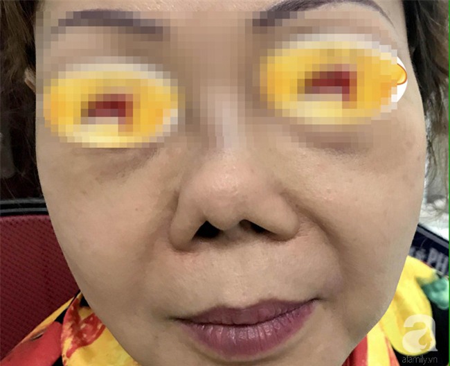 Lén chồng đi tiêm “mỡ nhân tạo” lên ngực, cô vợ 37 tuổi ở TP.HCM nhận cái kết nặng nề - Ảnh 4.