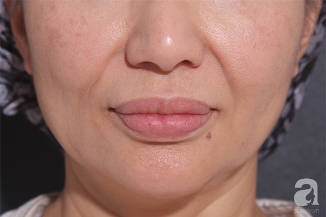 Lén chồng đi tiêm “mỡ nhân tạo” lên ngực, cô vợ 37 tuổi ở TP.HCM nhận cái kết nặng nề - Ảnh 6.