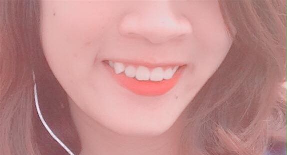 Khoe môi gợi cảm tiện thể khoe luôn ria mép, cô gái khiến cư dân mạng mắt xem ảnh tay nhặt mồm vì cười - Ảnh 7.