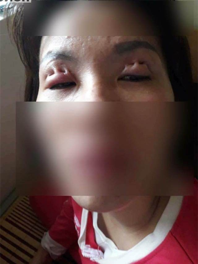 "tham hoa" cat mat gay xon xao nhung ngay qua se khien ban phai suy nghi lai! - 3