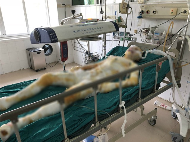Thông tin mới nhất về cô gái Vĩnh Phúc bị thiêu xăng khi đang ngủ - Ảnh 1.