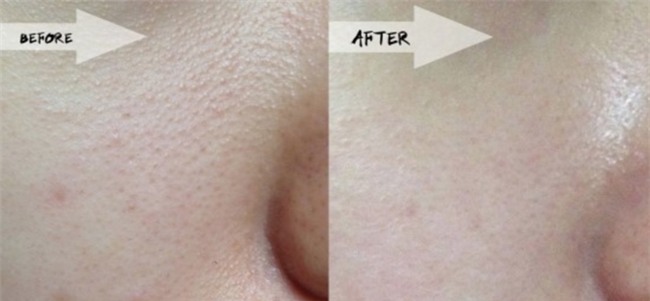 Thường xuyên trang điểm nhưng 5 người mẫu đến từ Hàn Quốc vẫn giữ được da căng mịn là nhờ vào mấy loại mặt nạ này - Ảnh 13.