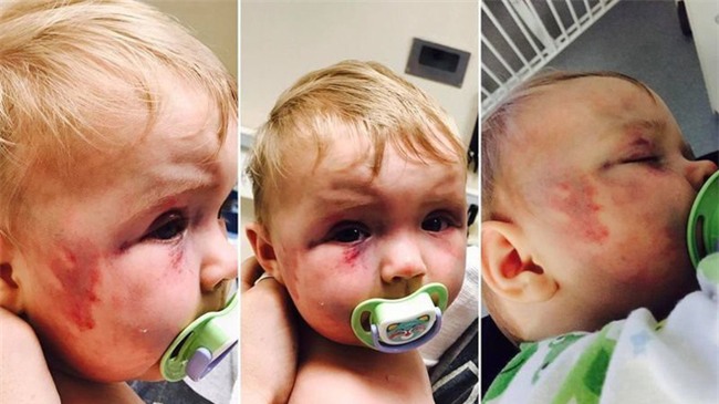 Dùng muỗng đánh dập mặt con gái 8 tháng tuổi nhưng không bị phạt tù, người mẹ độc ác còn nhắn tin khiêu khích chồng cũ - Ảnh 2.