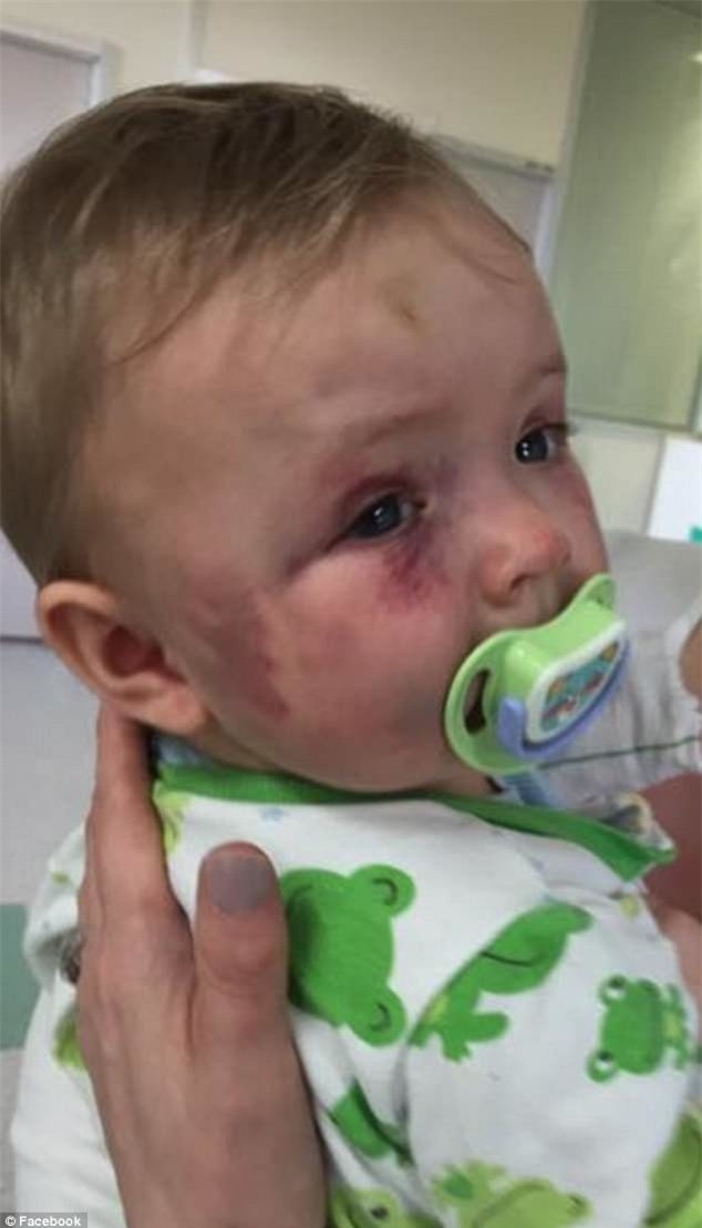 Dùng muỗng đánh dập mặt con gái 8 tháng tuổi nhưng không bị phạt tù, người mẹ độc ác còn nhắn tin khiêu khích chồng cũ - Ảnh 3.