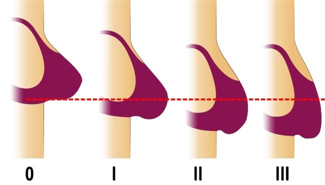 7 vật dụng trong nhà rất có ích nhưng lại làm hại sức khỏe, nhan sắc và khiến bạn già nhanh hơn - Ảnh 7.