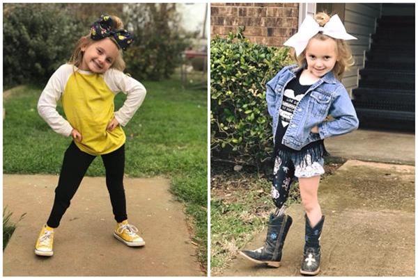 quyet dinh cat bo chan bi di tat bam sinh cua con, me tre da thay doi cuoc doi be - 10