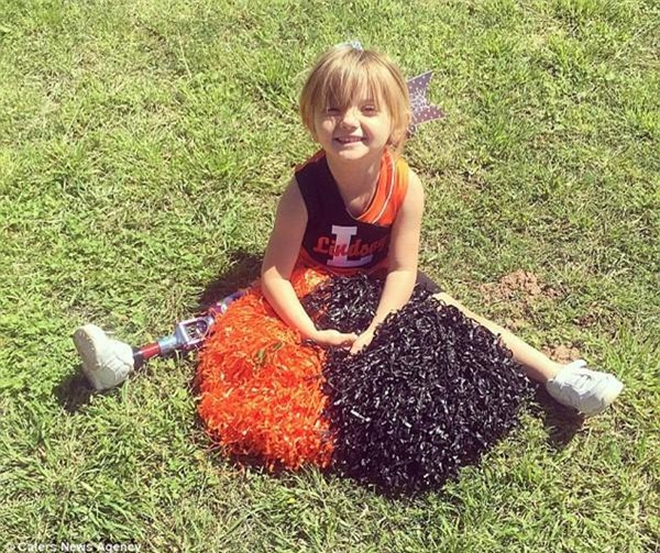 quyet dinh cat bo chan bi di tat bam sinh cua con, me tre da thay doi cuoc doi be - 6