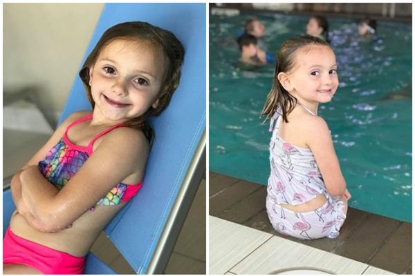 quyet dinh cat bo chan bi di tat bam sinh cua con, me tre da thay doi cuoc doi be - 7