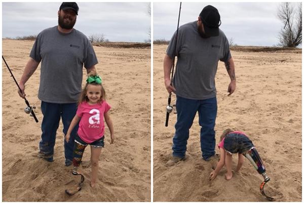 quyet dinh cat bo chan bi di tat bam sinh cua con, me tre da thay doi cuoc doi be - 9