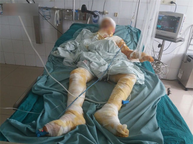 Vụ 2 cô gái bị thiêu sống ở Vĩnh Phúc: Nằm trên giường bệnh, người mẹ đau đớn nhìn con qua màn hình điện thoại cho vơi nỗi nhớ