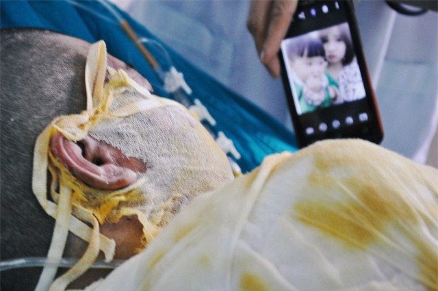 Vụ 2 cô gái bị thiêu sống ở Vĩnh Phúc: Nằm trên giường bệnh, người mẹ đau đớn nhìn con qua màn hình điện thoại cho vơi nỗi nhớ