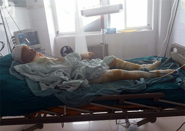 Hoàn cảnh bi đát của cô gái trẻ lao vào cứu bạn trong vụ bị người tình tẩm xăng thiêu sống - Ảnh 5.