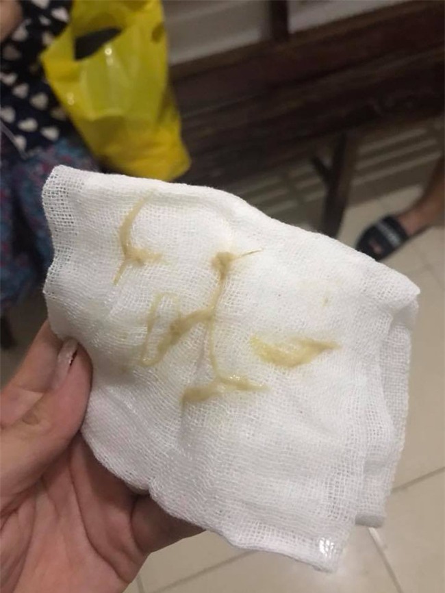 Để con trai chơi cùng hộp giấy ăn, mẹ trẻ suýt ân hận cả đời vì con bị tắc phổi, suy hô hấp đến tím tái cả người - Ảnh 2.